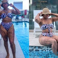 Plane Crash Survivor, Kechi Okwuchi shares stunning photos of herself in a bikini