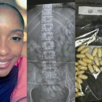 Police report arrest of Namibian woman at airport with belly full of drugs