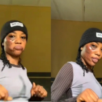 Lady baptized Roommate with hot water for after catching her chatting with her boyfriend