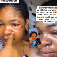 Lady reveals what lover did to her face after she requested N150K for wig