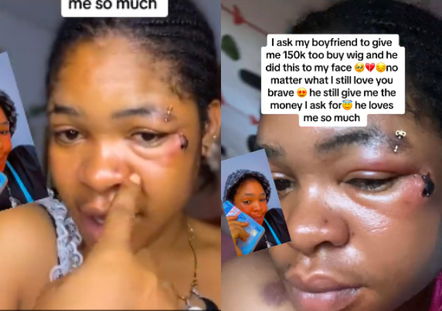 Lady reveals what lover did to her face after she requested N150K for wig